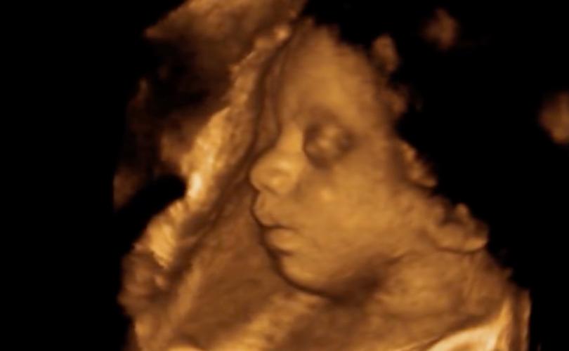 Federal Court Upholds Kentucky Law Forcing Abortionists to Offer Women Ultrasounds